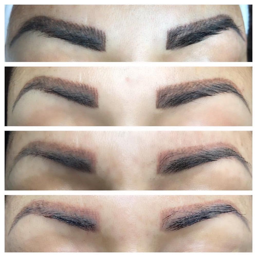 eyebrow tattoo removal before and after