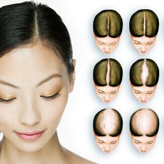 how long does scalp micropigmentation last