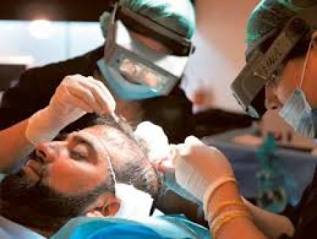 hair transplant procedure
